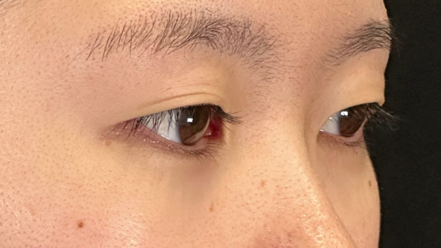 手术前的状态 其一