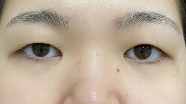 手术前的状态 其一