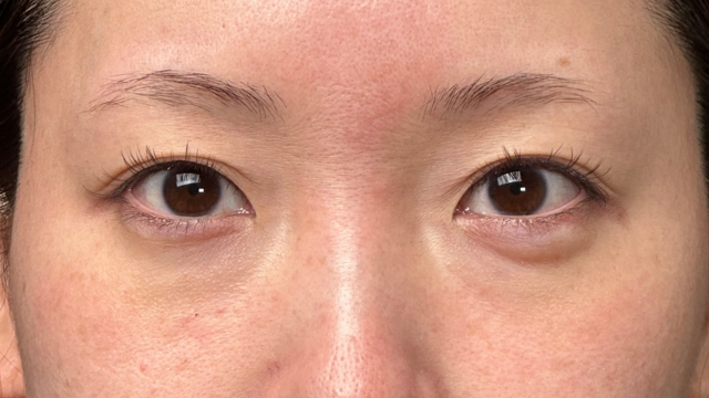 手术前的状态 其一