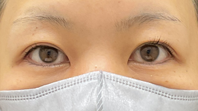 手术前的状态 其一