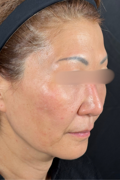 手术前的状态 其一