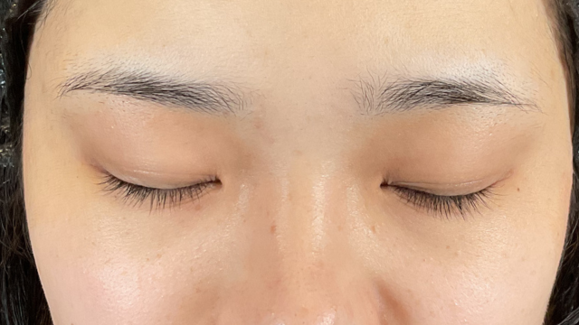 手术前的状态 其一