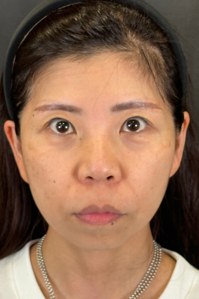 Preoperative Condition Part 1