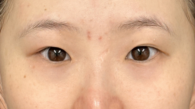 Preoperative Condition Part 1