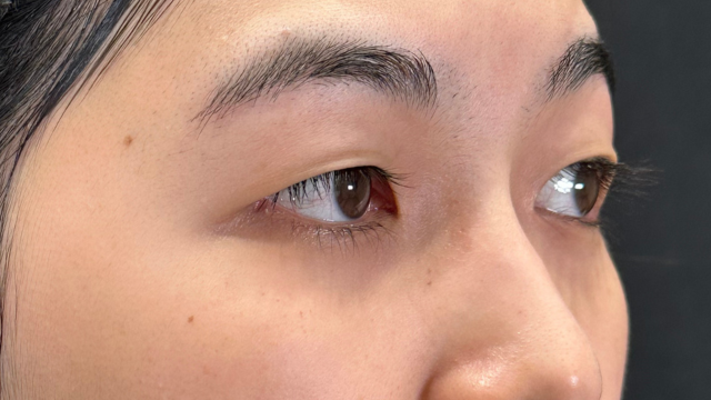 手术前的状态 其一