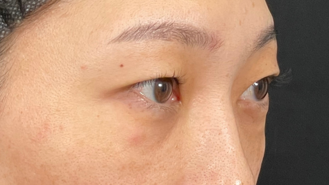 手术前的状态 其一