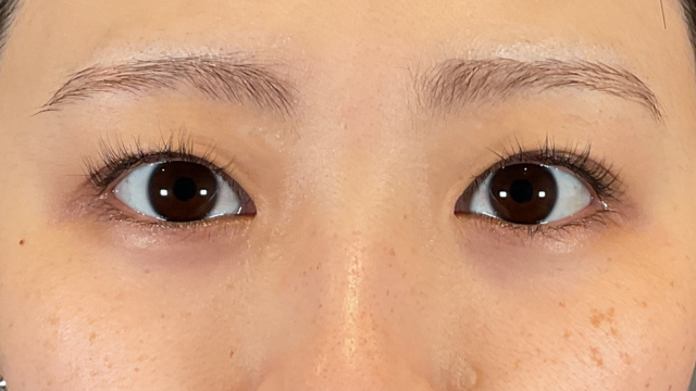 手术前的状态 其一