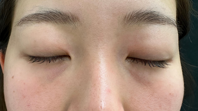 手术前的状态 其一