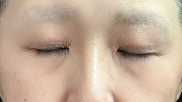 Preoperative Condition Part 1