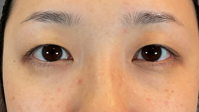 手术前的状态 其一