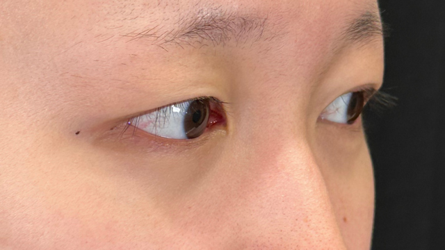 Preoperative Condition Part 1