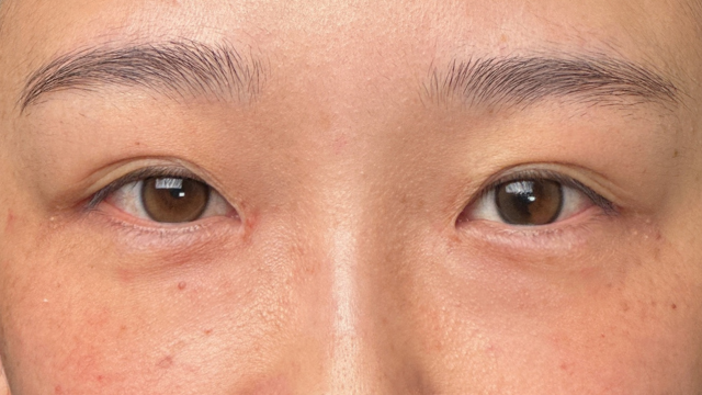 Preoperative Condition Part 1