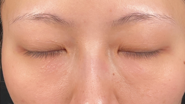 手术前的状态 其一