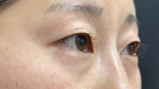 手术前的状态 其一