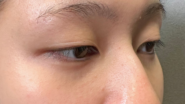 手术前的状态 其一