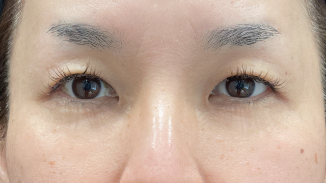 手术前的状态 其一