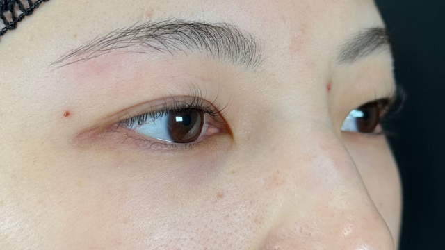 手术前的状态 其一