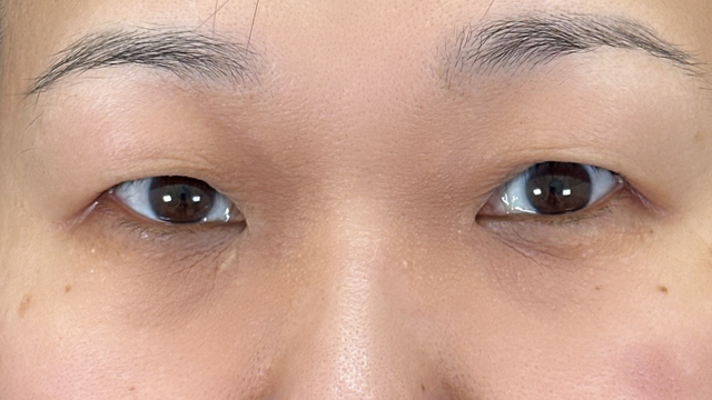 Preoperative Condition Part 1