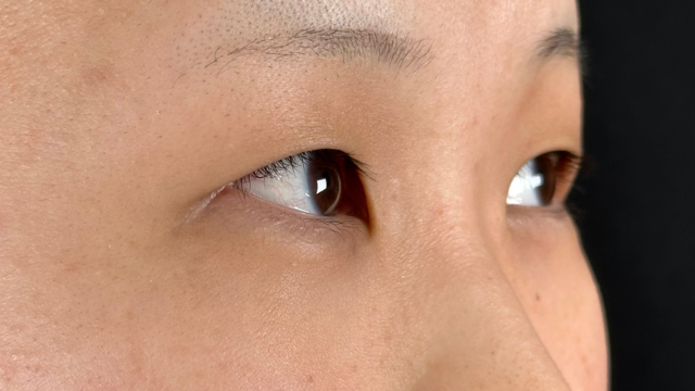 手术前的状态 其一