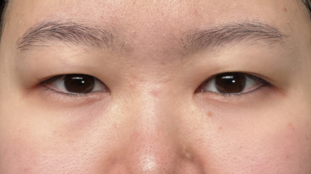 Preoperative Condition Part 1