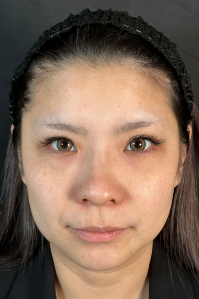 手术前的状态 其一