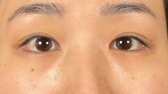 手术前的状态 其一