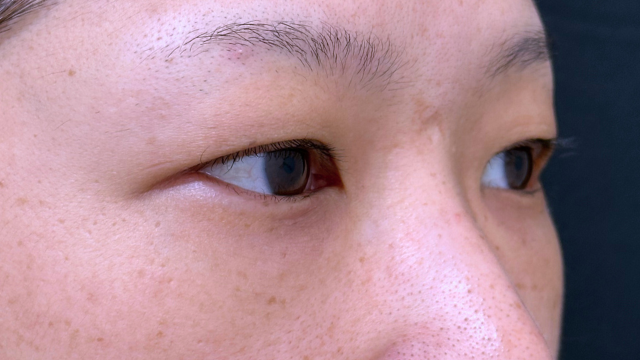 Preoperative Condition Part 1