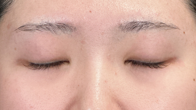 手术前的状态 其一