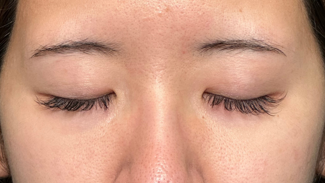 手术前的状态 其一