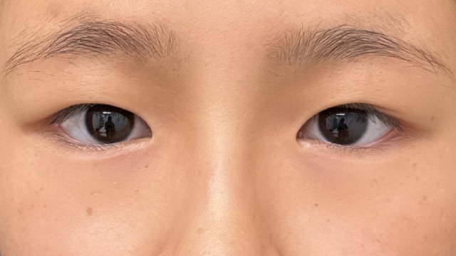 Preoperative Condition Part 1