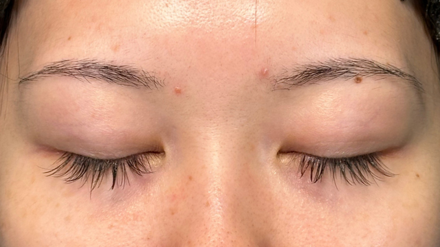 Preoperative Condition Part 1