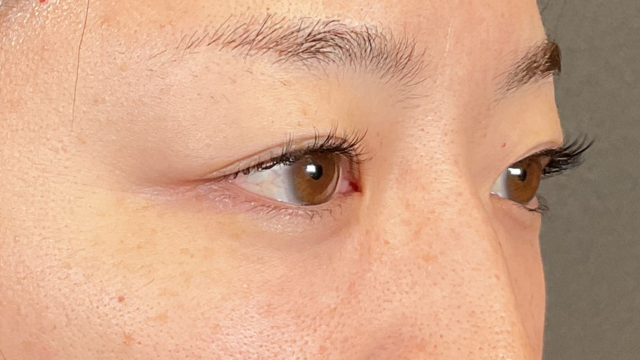 手术前的状态 其一