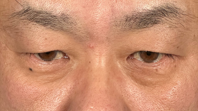 Preoperative Condition Part 1