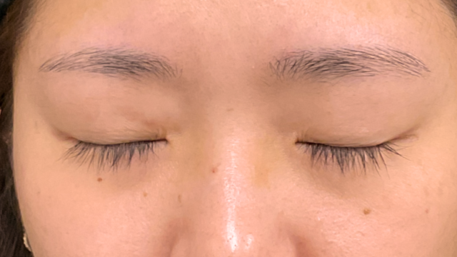 手术前的状态 其一