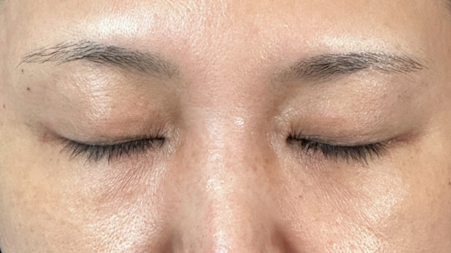 Preoperative Condition Part 1