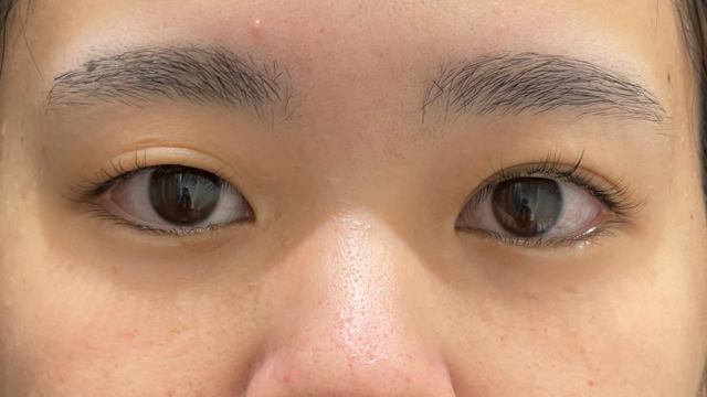 Preoperative Condition Part 1