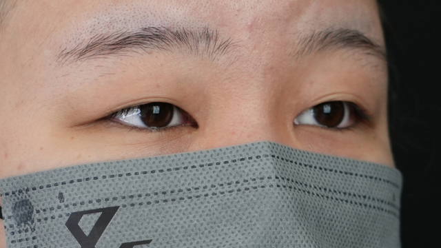 Preoperative Condition Part 1