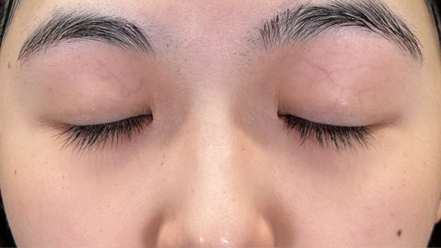 手术前的状态 其一