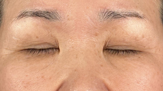 Preoperative Condition Part 1