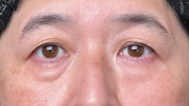 Preoperative Condition Part 1