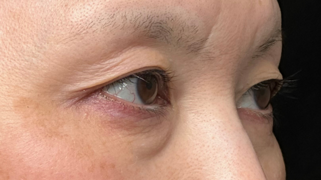 手术前的状态 其一