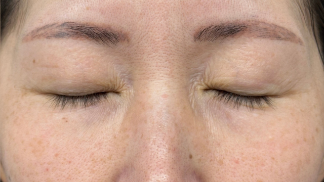 手术前的状态 其一