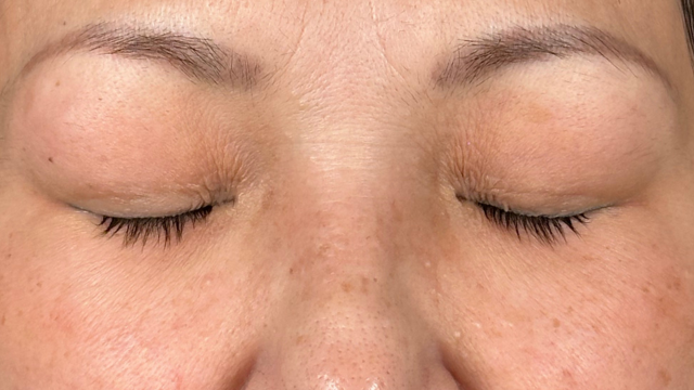 Preoperative Condition Part 1