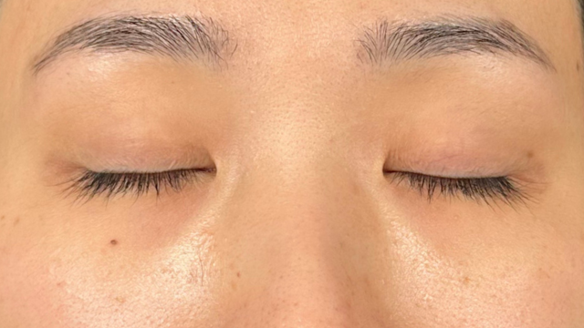 手术前的状态 其一