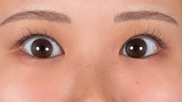 手术前的状态 其一