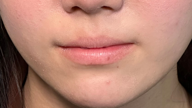 Preoperative Condition Part 1