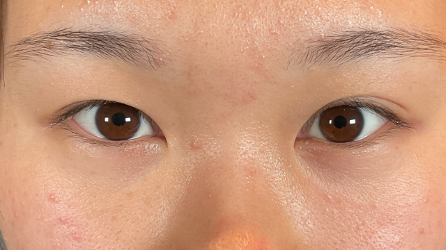 手术前的状态 其一