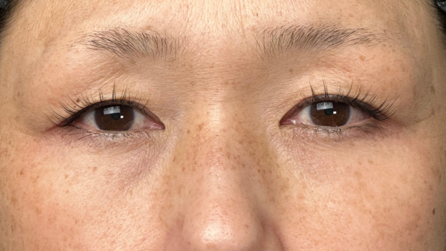 Preoperative Condition Part 1