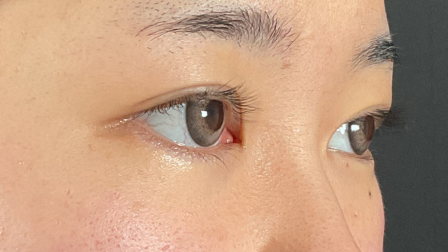 手术前的状态 其一