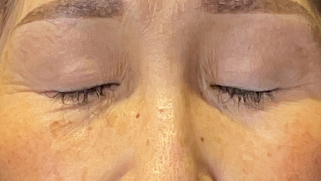 手术前的状态 其一